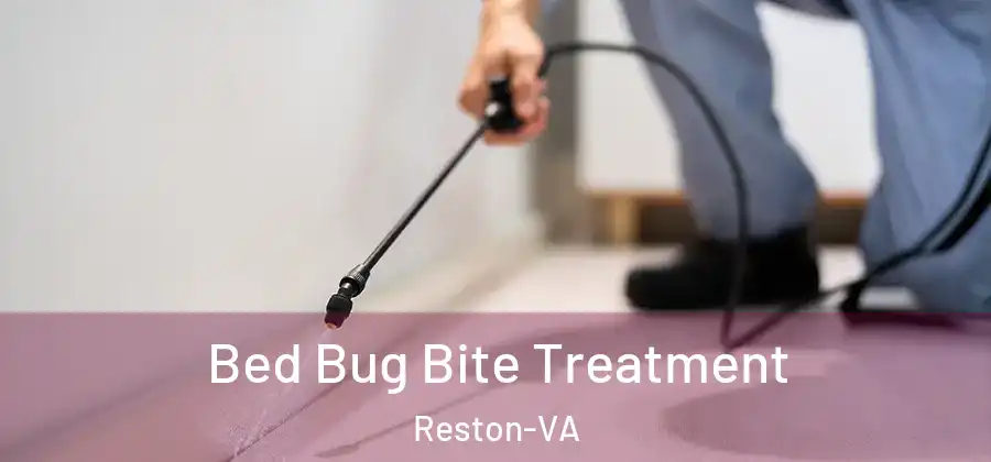 Bed Bug Bite Treatment Reston-VA